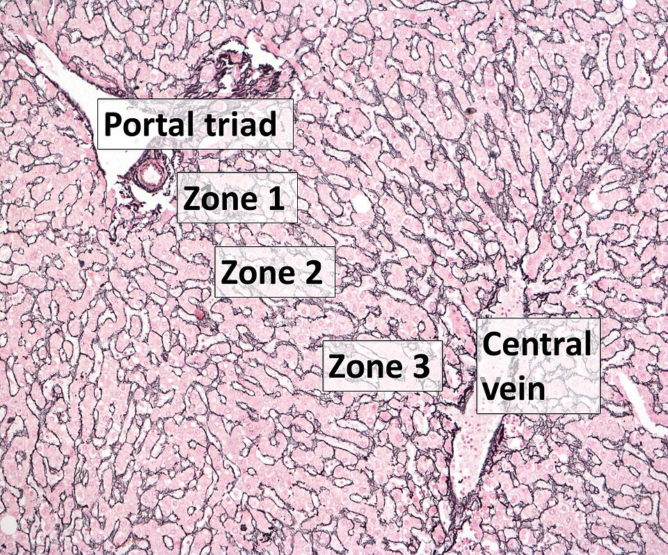 Normal human liver: reticulin stain with zones labelled. Portal triad (Zone 1) to central vein (Zone 3). Hepatocyte plates outlined in reticulin fibres.